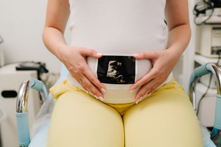 Pregnant woman holds an ultrasound photo of her baby on her tummy. Filming precious moments of motherhood with sonogramの写真素材