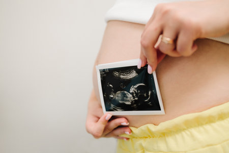 Pregnant woman holds her baby ultrasound photo on her belly. Mother is holding sonogram picture of baby on her belly close-up.の写真素材