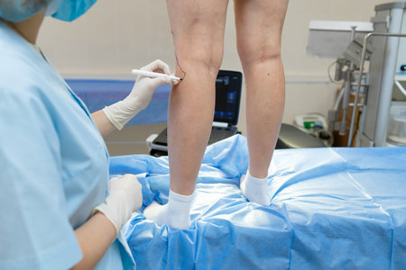 Doctor performing vein markings for leg treatment