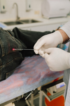 Anal laser therapy for hemorrhoids performed by doctor on male patient