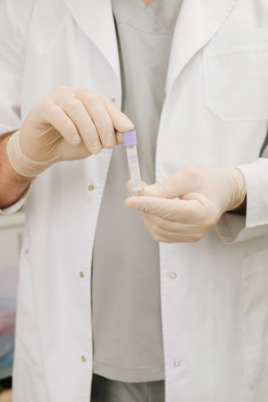 Lab diagnostics urology patient samples ready for medical evaluation