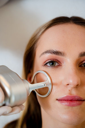 Cosmetologist performs CO2 laser resurfacing for wrinkle and scar removal on face