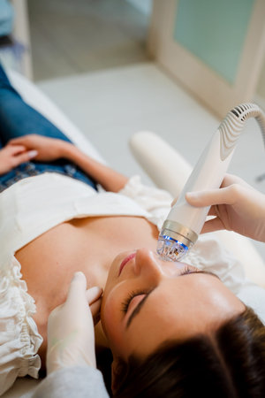 RF needle fractional facial lift for skin renewal in medical cosmetology