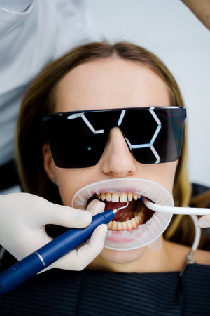 Routine dental checkup with probe to check teeth for cavities by dentist