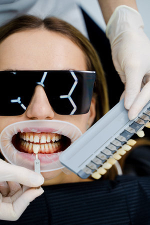 Accurate tooth color matching with dental shade guide by professional dentistの写真素材