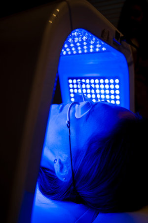 Patient undergoes facial LED light therapy in dome sessionの写真素材