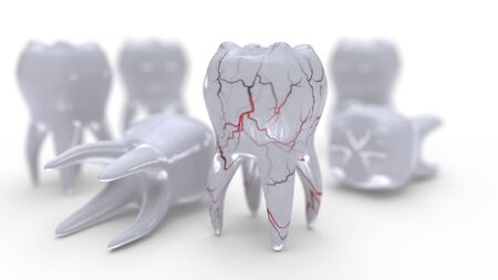 Tooth model and veins on the white, 3d renderの写真素材