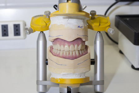 denture work in progress