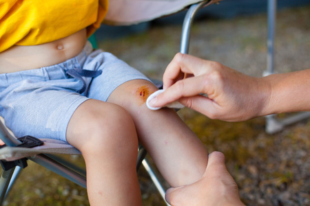 Mother treats her son skinned knee (Shallow DOF).