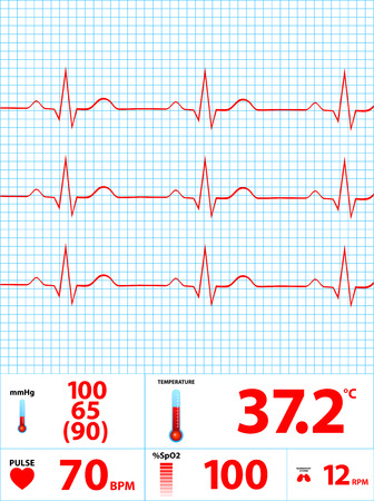 Modern Electrocardiogram Monitor Displayのイラスト素材
