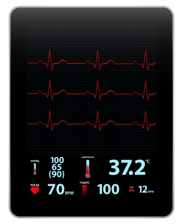 Modern Electrocardiogram Monitor Device Displayのイラスト素材