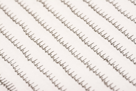 Normal Electrocardiogram Record On Paperの写真素材