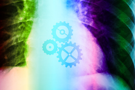 X-Ray Photo Of Human Showing Working Heart With Cog Wheelsの写真素材