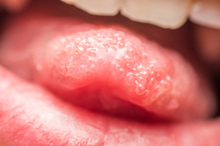 Close Up Photo Of Healthy Human Tongue Taste Buds Macroの写真素材