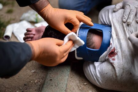 Paramedics providing first aid assistance to a collapsed person presenting a head injuryの写真素材