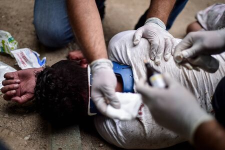 Paramedics providing first aid assistance to a collapsed person presenting a head injury の写真素材