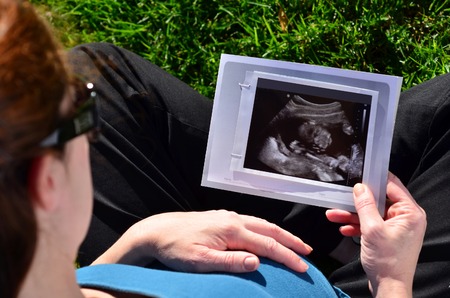 Pregnant woman looking at ultrasound scan of baby, close up of scan. Concept photo of pregnancy,...