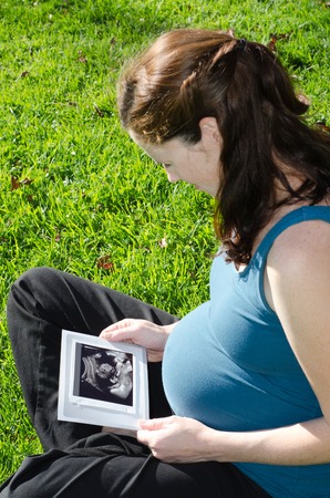 Pregnant woman looking at ultrasound scan of baby, close up of scan. Concept photo of pregnancy, pregnant woman, family, parenthood, motherhood.copyspaceの写真素材