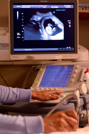 KAITAIA, NZ - NOV 05:Ultrasound scanning on Nov 05 2013.A pregnancy ultrasound is an imaging test that uses sound waves to see how a baby is developing in the womb.のeditorial素材