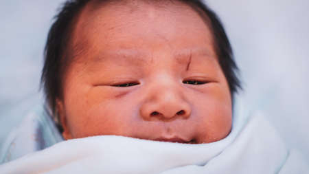 A wound on the newborn's forehead caused by a scalpel in the delivery room. Close up Newborn Baby in...