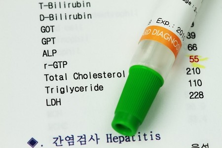Medical result with spatula - concept for medical check-upの写真素材