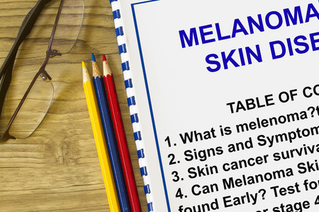 Melanoma skin cancerの写真素材