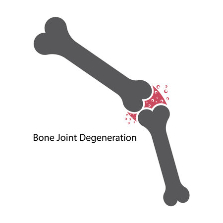 Bone joint degeneration icon,vector symbol designのイラスト素材