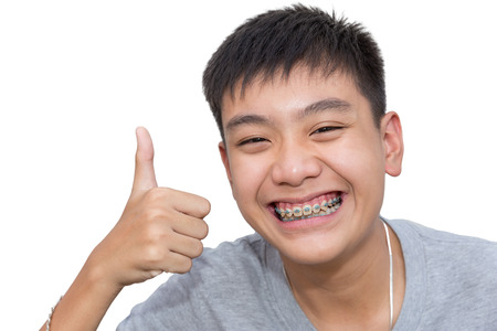 Beautiful smiling of handsome boy with teeth brace dental and great hand sign on isolated background.の写真素材