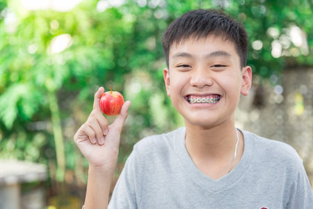 Beautiful smiling of handsome boy with teeth brace dental holding apple.の写真素材