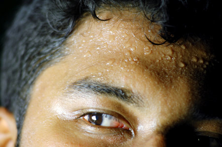 Close up of a man's eyes with water drops on his forehead.