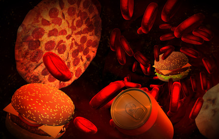 Cholesterol blocked artery, medical concept with a human blood vessel clogged by unhealthy eating fast food as hamburgers, pizza, ice cream and fried foods,health risk for obesity nutrition problemsの写真素材