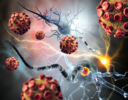 3d illustration of viruses attacking nerve cells, concept for Neurologic Diseases, tumors and brain surgery.の写真素材
