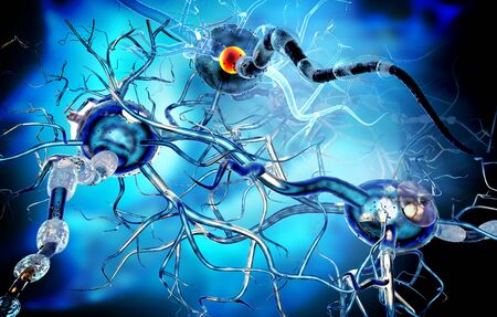 3d illustration of nerve cells, concept for Neurological Diseases, tumors and brain surgery.