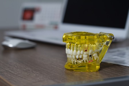 The dental tooth dentistry student learning teaching model showing teeth, roots, gums, gum disease, tooth decay and plaque.の写真素材