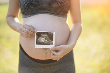 Pregnant woman holding ultrasound image of her childの写真素材