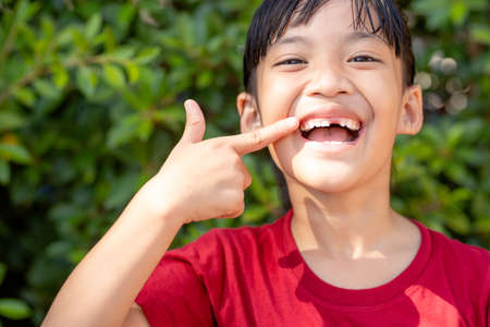 little girl showing her broken milk teeth