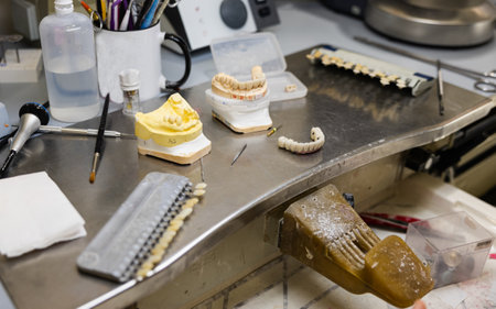 A dental office with a table full of dental tools and materials. The table has a yellow and white...