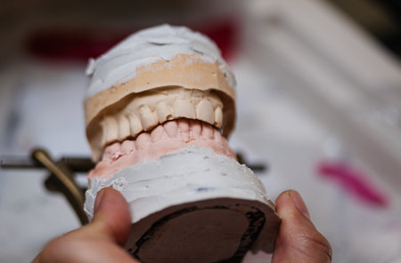 A person is holding a dental model in their hand. The model is made of a white material and has a...