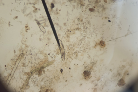 Demodex parasite under skin dog take photo from microscope