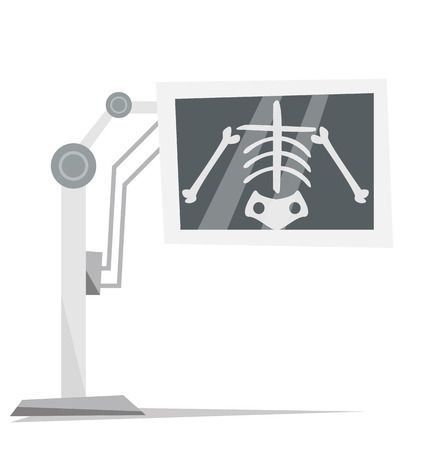 X-ray machine with image of skeleton vector flat design illustration isolated on white background.のイラスト素材