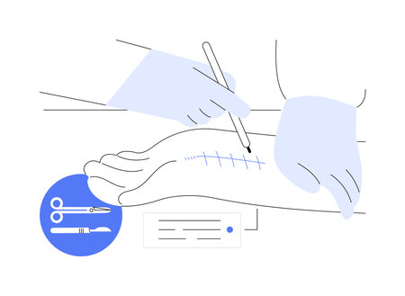 Hand surgery abstract concept vector illustration.のイラスト素材