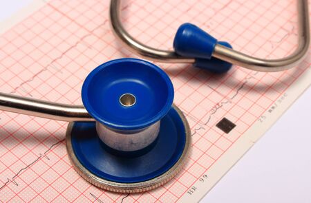 Medical stethoscope and electrocardiogram graph ekg heart rhythm, medicine concept