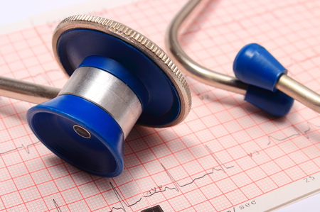 Medical stethoscope and electrocardiogram graph ekg heart rhythm, medicine conceptの写真素材