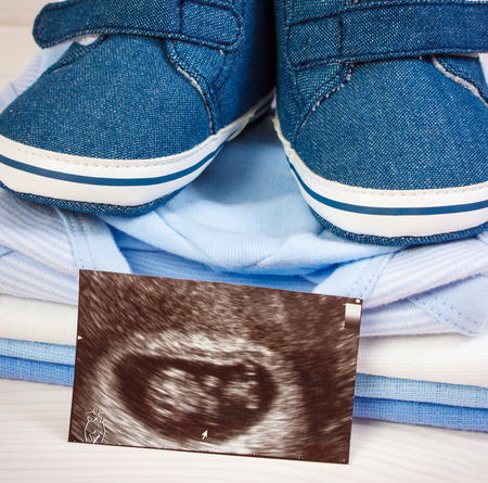 Ultrasound scan of baby and clothing for newborn on boards, concept of extending family and expecting for babyの写真素材