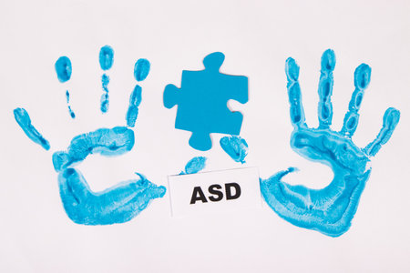 Blue kid handprint made of paint and inscription ASD. Autism Spectrum Disorder. White backgroundの写真素材