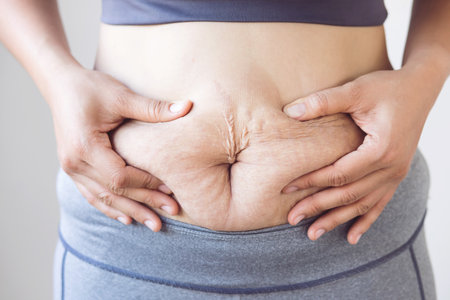 Obese women want to lose weight By exercising and dietingの写真素材