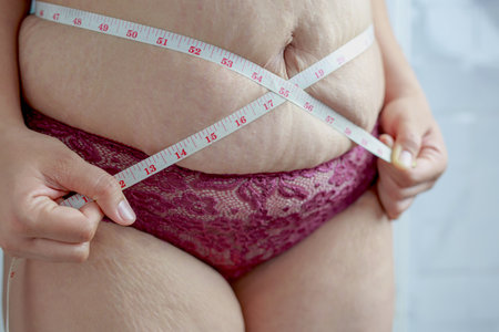 Obese women with belly patternの写真素材