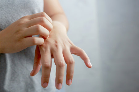 A woman is itchy skin, she's allergic to dust.の写真素材