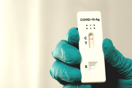 Doctor with Covid-19 test kit from the lab at the hospitalの写真素材