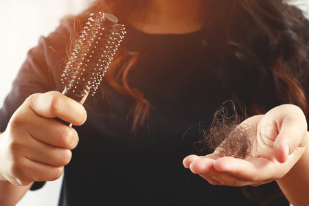 young woman worried about Hair loss problem after comb in hand. problem hormonal disbalance, stress concept. Health care concept.の写真素材